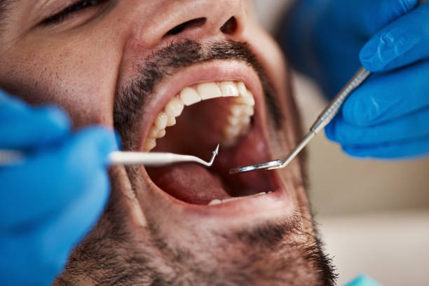 Best Cracked Tooth Emergency Dentist  in Chevy Chase Heights, PA